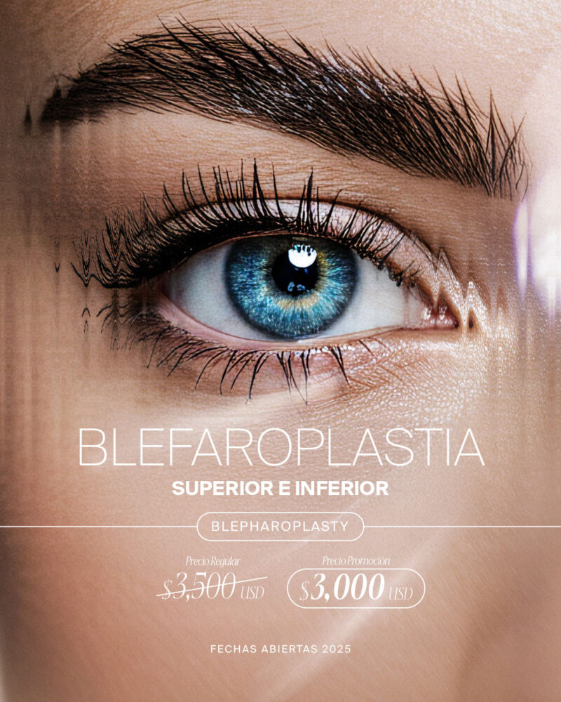 BLEFA BLEFA
